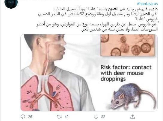اعراض فيروس هانتا